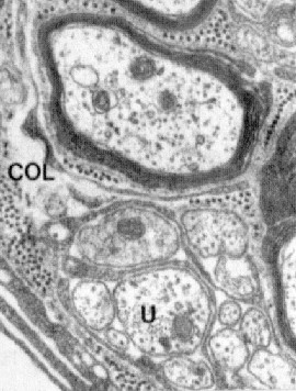 Figure 1-4